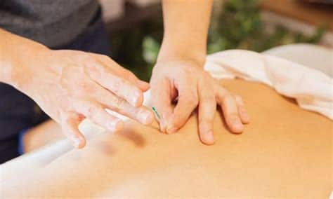 Agopuntura Tradizionale Varese - terapia per il controllo del peso