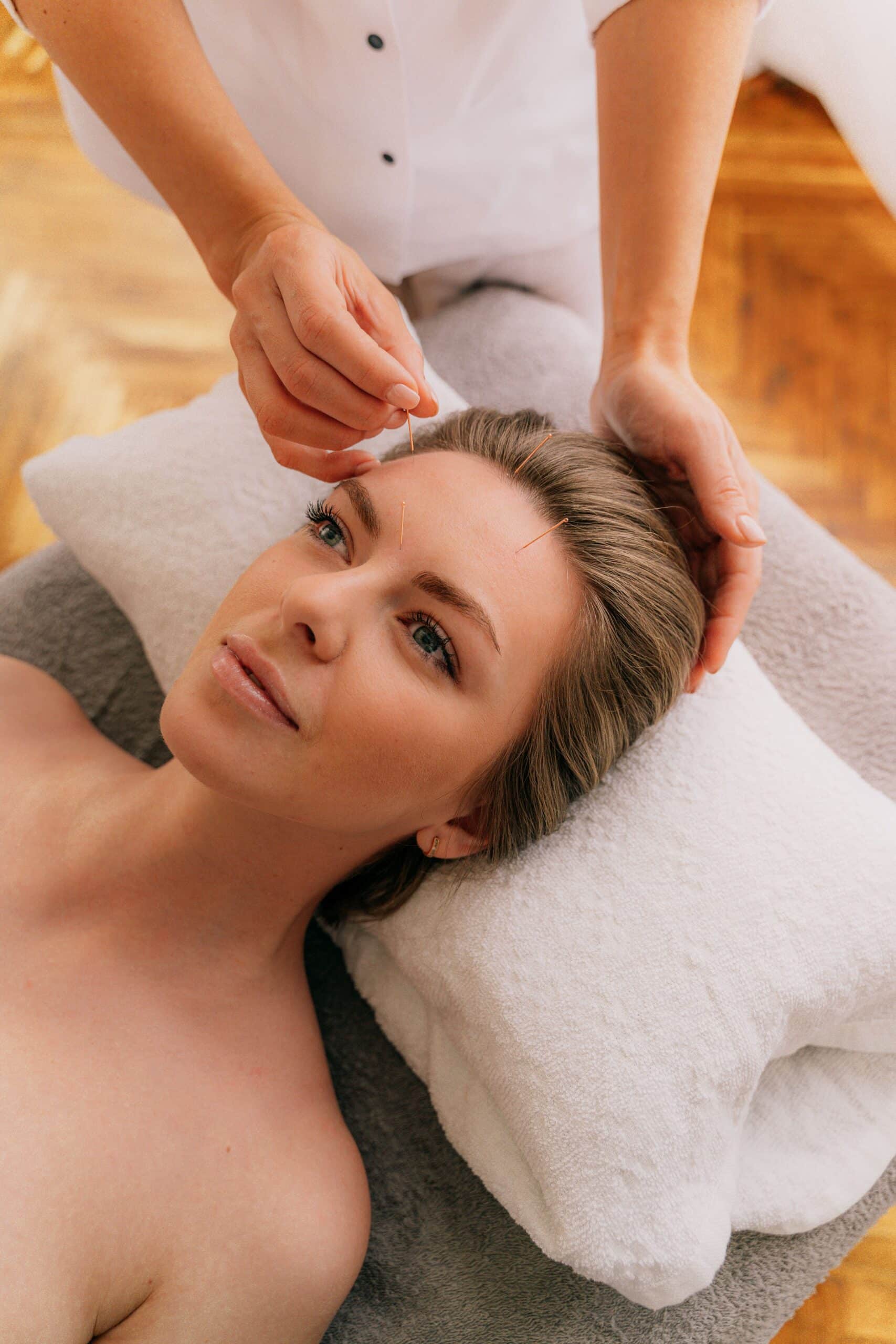 Agopuntura e stress: un approccio naturale