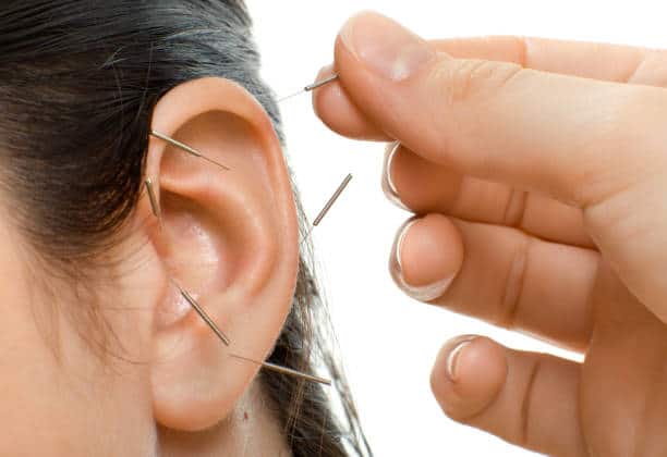 Trattamenti di agopuntura offerti dal Dr. Castaldi - auricoloterapia