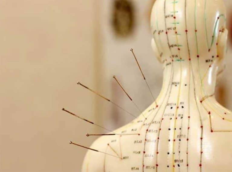 Agopuntura Tradizionale Varese - mappa agopunti